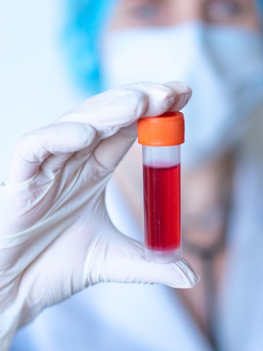 Una provetta con un campione di sangue, tenuta con guanti da laboratorio